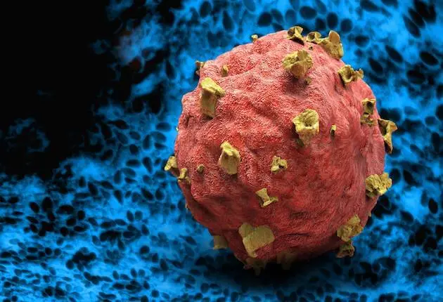 SEBAGAI ANTIOKSIDAN DAN BERSIFAT ANTITUMOR